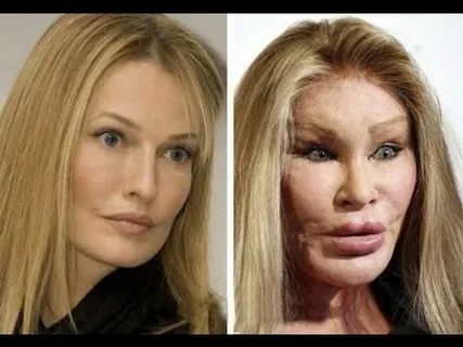 ������������ ��������: ����� ���������� � ������ ���������� ���������