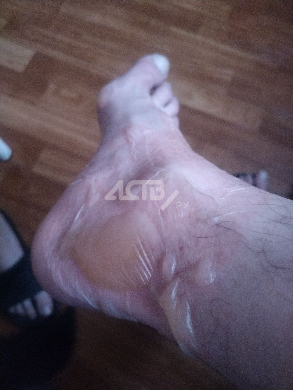 Южносахалинец получил ожоги ноги, пробежавшись по кипятку на месте порыва теплотрассы