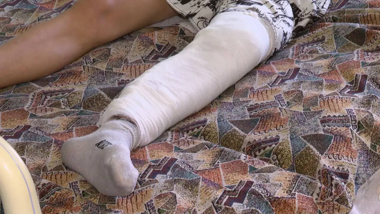 Свыше 130 пациентов приняли в травматологическом отделении детской областной больницы за первую неделю 2026-го Свыше 130 пациентов приняли в травматологическом отделении детской областной больницы за первую неделю 2026-го