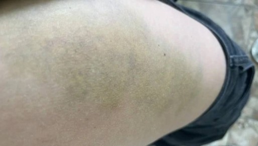 ����� ������� � ���� �� ����: ������ ���������� ����-���������� ���������� � ������ ��������