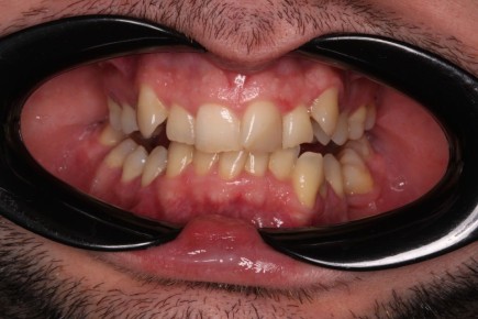 ����������� �����: ������ ����������� ������ ������������ � ��� �� ��������