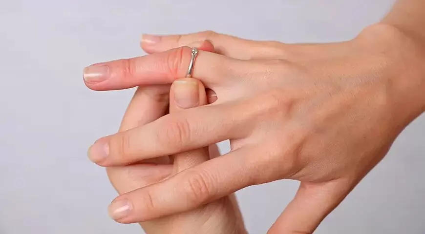 Как избавиться от отеков: Правильные продукты и советы для здоровья